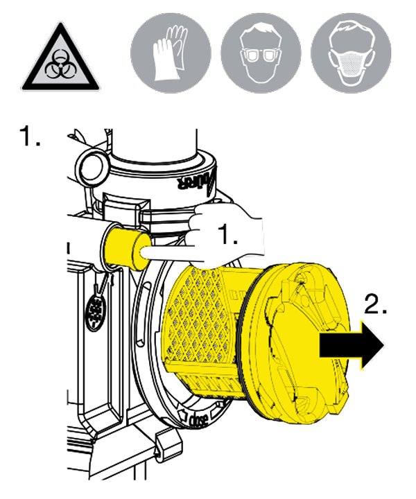 Protective sieve yellow,  Cuspidor valve, Version 3